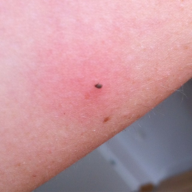 17179636000_8741ae0f23_z